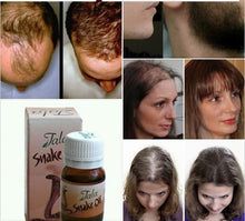 Load image into Gallery viewer, Tala Snake Oil 20Cc - REMOVES HAIR WITH SNAKE OIL FORMULA - 100% NATURAL FORMULA
